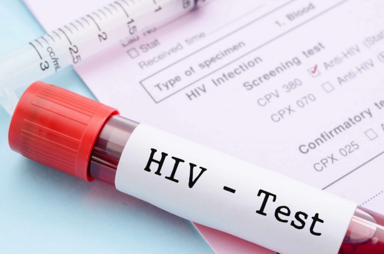 at-home-hiv-test-1024x678